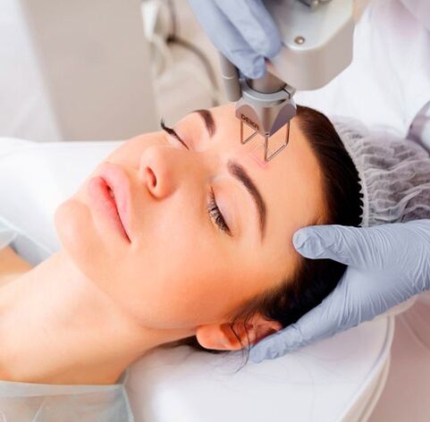 Facial laser rejuvenation