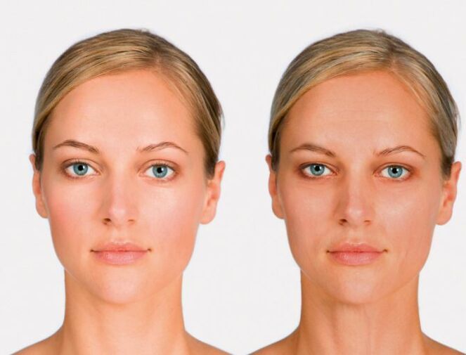 After rejuvenation and first