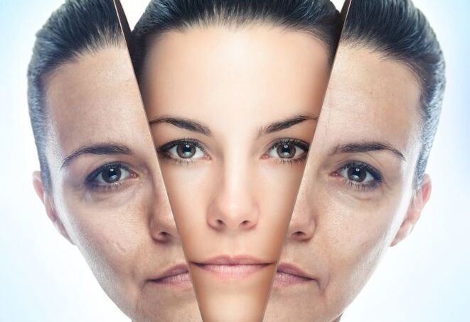 Procedure to remove age-related changes in facial skin